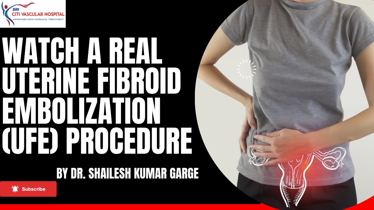 specialist for fibroids in hyderabad