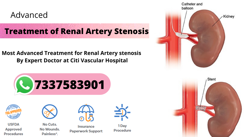 renal artery stenosis treatment in hyderabad