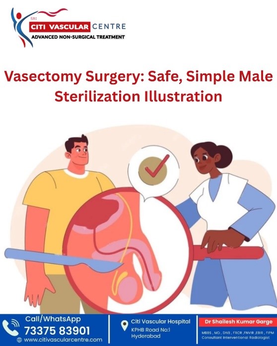 vasectomy surgery safe simple male sterilization illustration