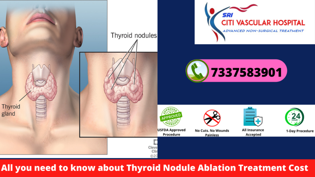 thyroid treatment in hyderabad 