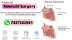 adenoid treatment without surgery