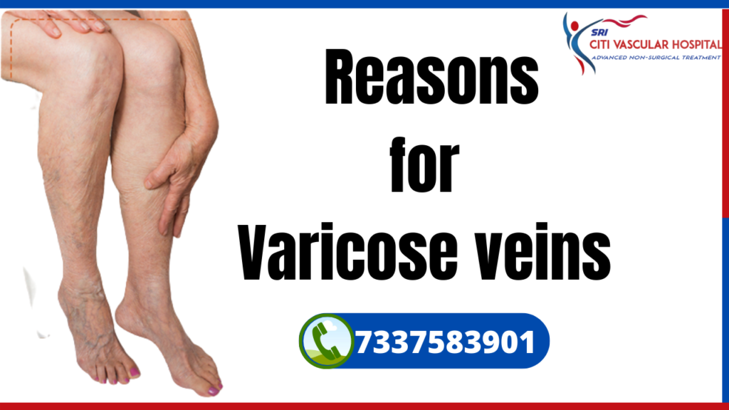 best hospital for varicose veins