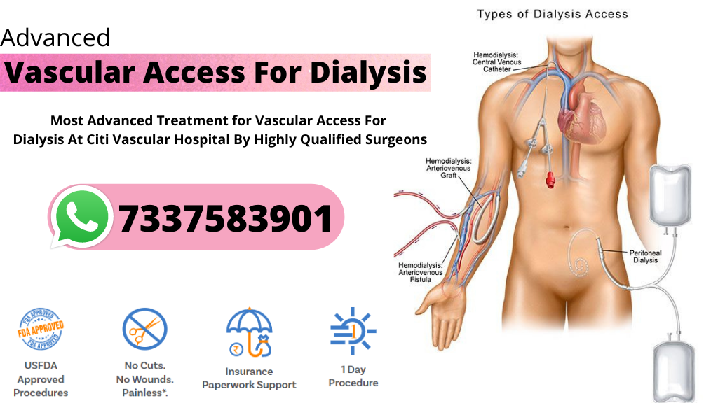 vascular dialysis access treatment in hyderabad