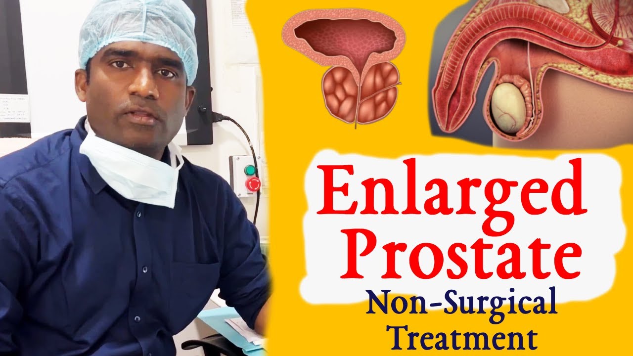 prostate treatment in Citi Vascular Centre