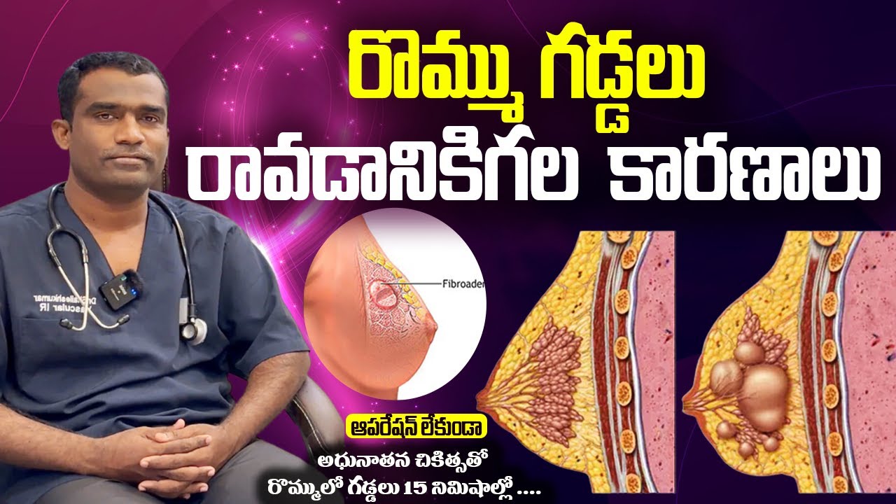 Treatment Breast Fibroadenoma in Hyderabad 