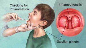 tonsils surgery cost in hyderabad