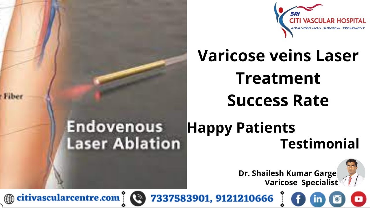 specialist for varicose veins near me