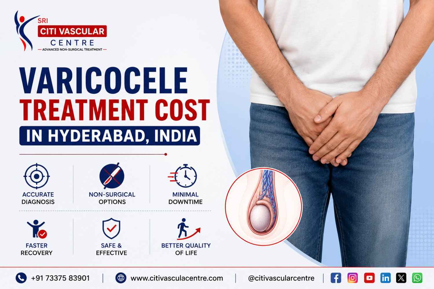Varicocele treatment cost Hyderabad  embolization vs surgery Citi Vascular KPHB
