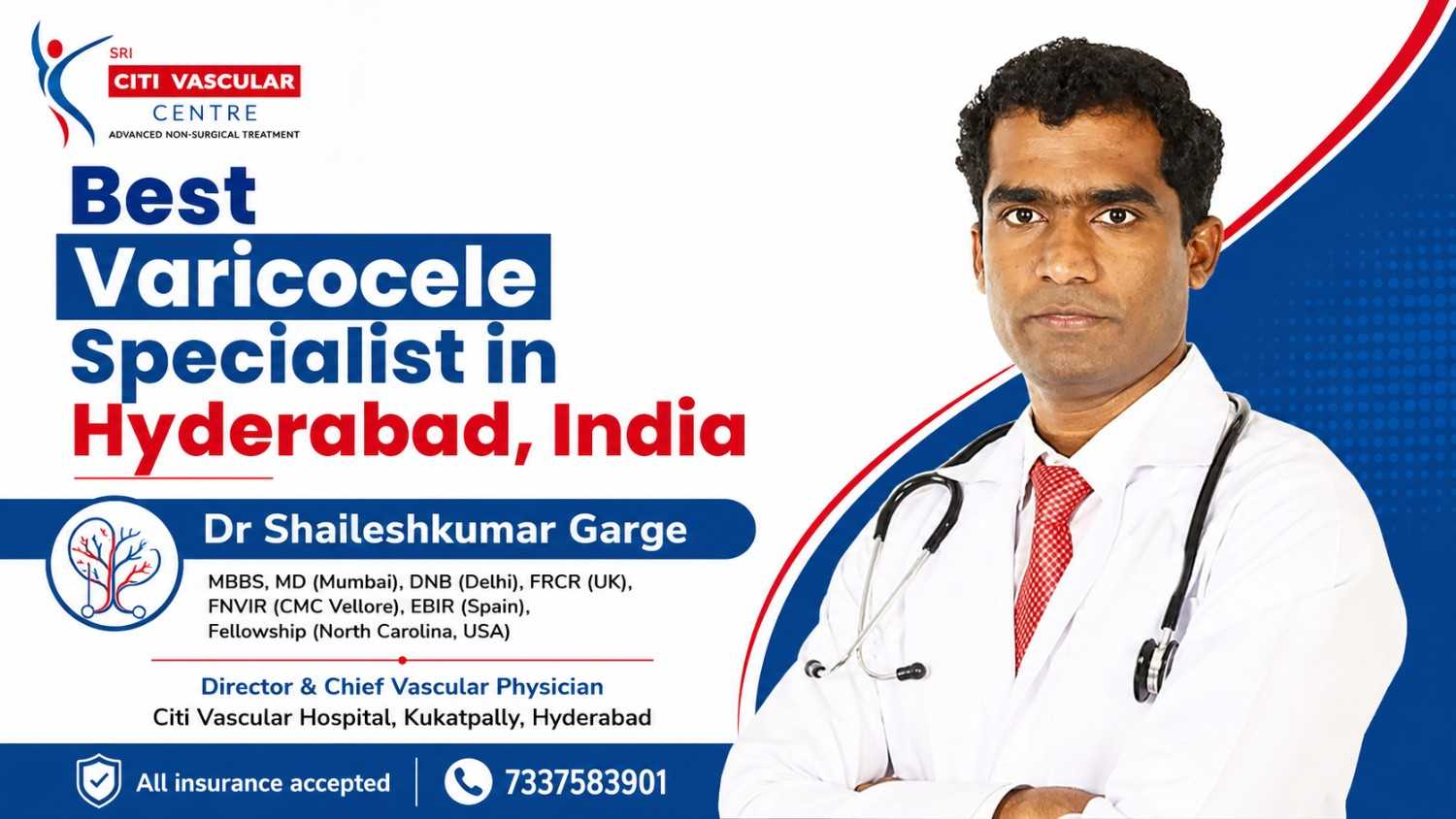 Medical illustration showing varicocele enlarged scrotal veins with annotated symptoms causes grades and treatment options in Hyderabad 