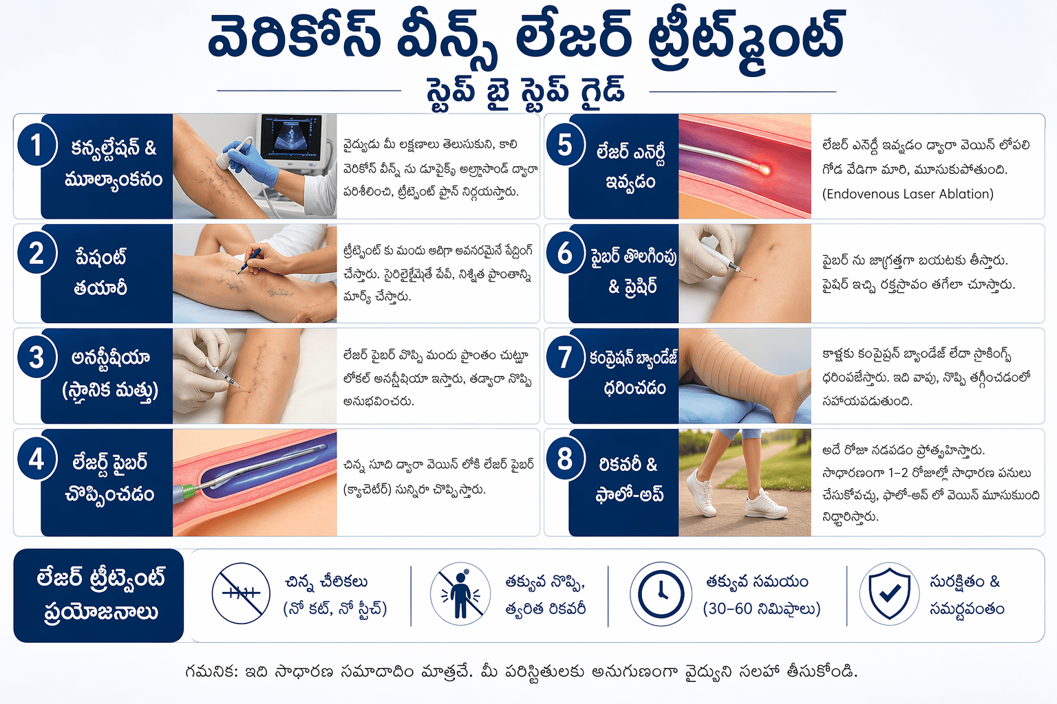 Varicose Veins Laser Treatment Procedure Image