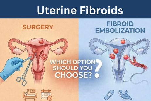 uterine fibroid embolisation treatment in hyderabad at citi vascular centre