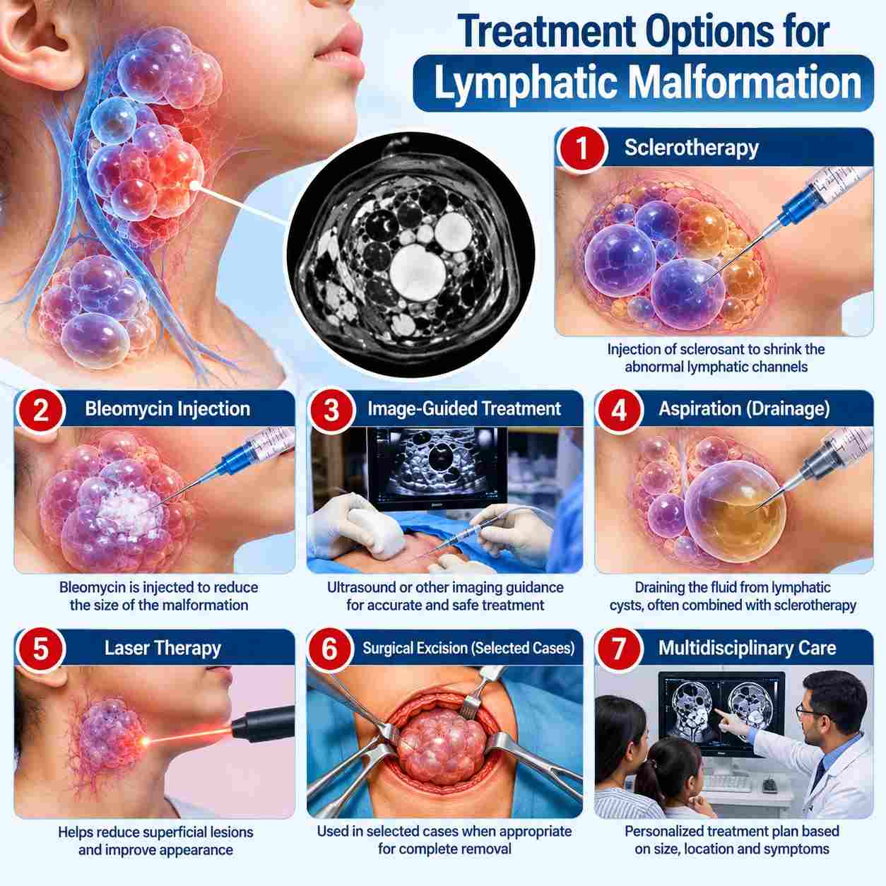 Treatment options for lymphatic malformation including sclerotherapy, Bleomycin injection, image-guided treatment, aspiration, laser therapy, selected surgical excision, and multidisciplinary care.