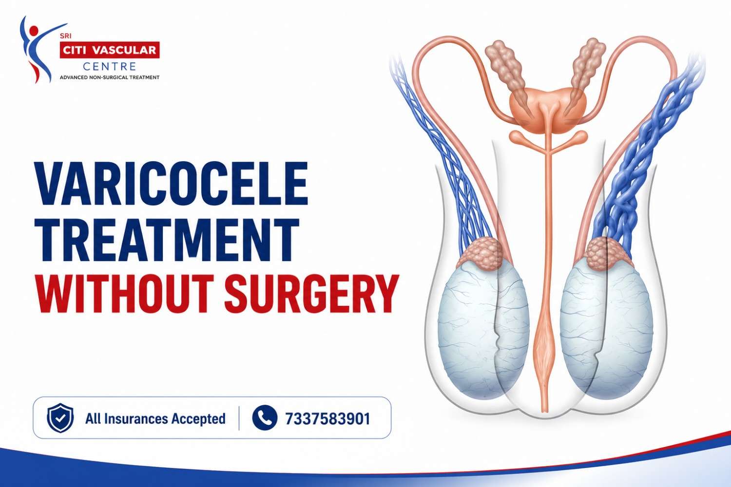 Dr. Shaileshkumar Garge best varicocele specialist in Hyderabad explaining non-surgical varicocele embolization treatment at Citi Vascular Hospital Kukatpally