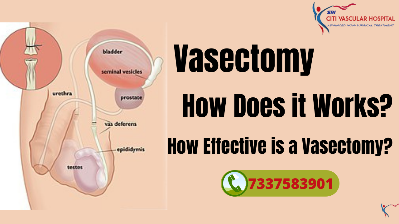 vasec