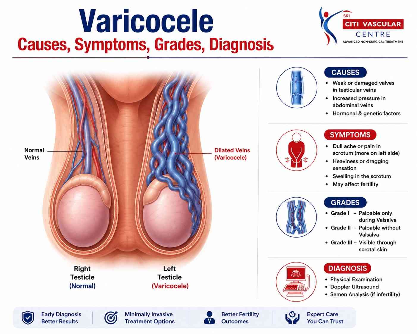 Varicocele symptoms causes grades diagnosis treatment Hyderabad Citi Vascular KPHB Dr Shaileshkumar Garge