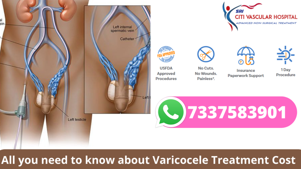 Varicocele Healing - Varicocele Pain Treatment