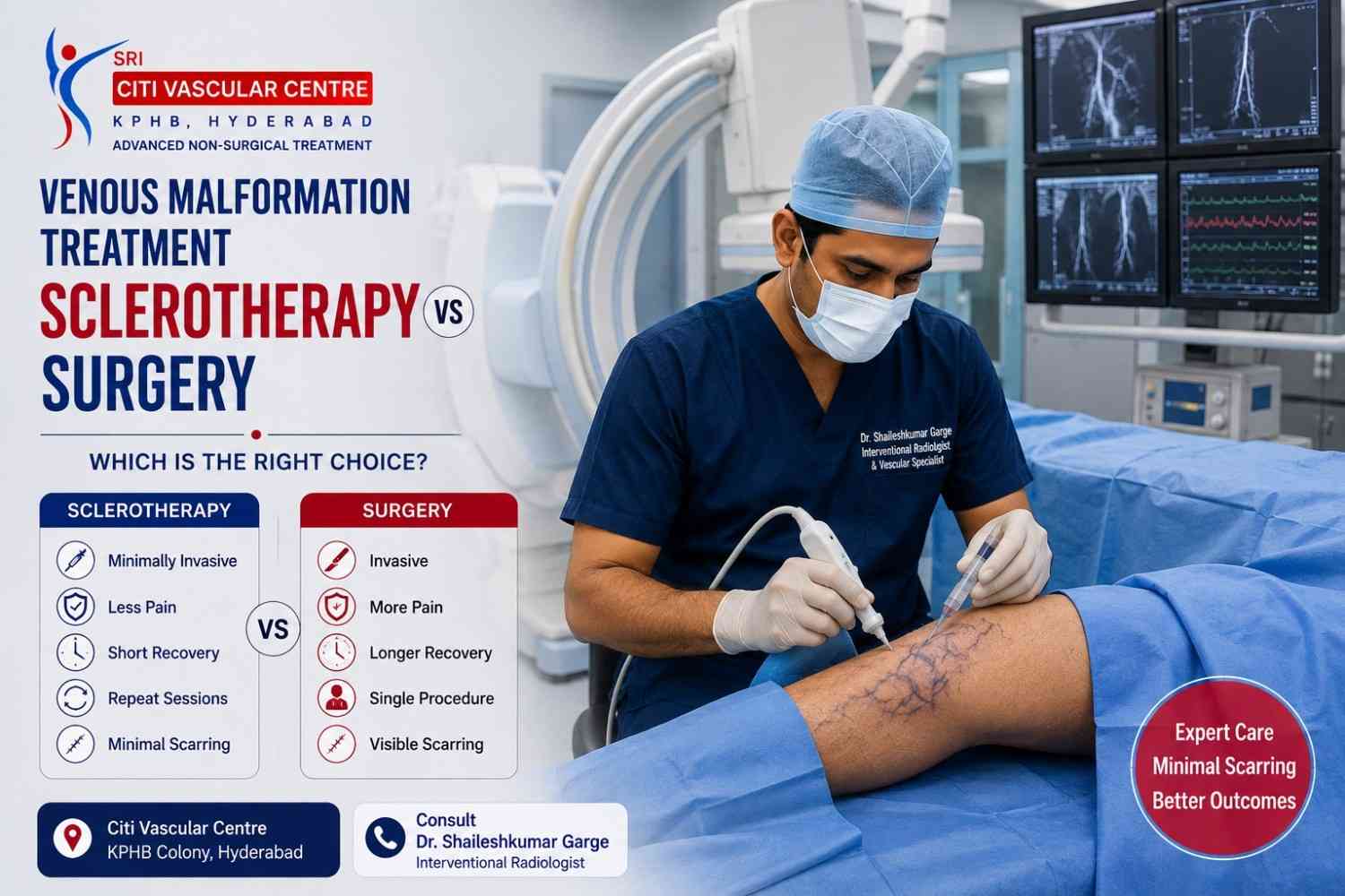 Venous malformation sclerotherapy vs surgery Hyderabad best treatment vascular malformation comparison Dr Garge Citi Vascular Centre KPHB