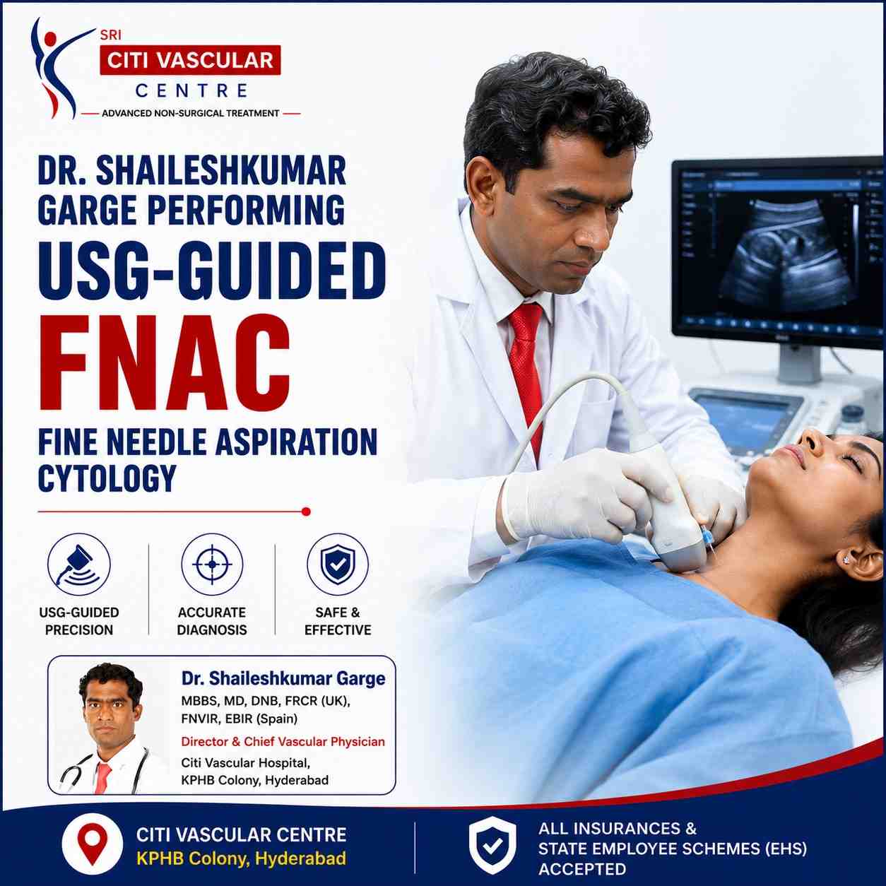 Dr. Shaileshkumar Garge performing USG-guided FNAC fine needle aspiration cytology under real-time ultrasound at Citi Vascular Centre KPHB Hyderabad 